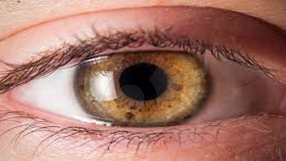تعرف على أعراض الإصابة بسرطان العين