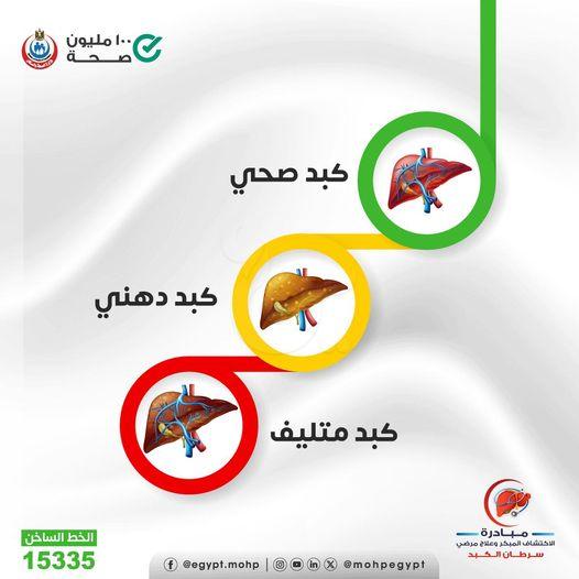 «الصحة»: دهون الكبد وتضخمه قد تؤدي لسرطان الكبد والمتابعة والعلاج بالمجان - 1 - سيناء الإخبارية