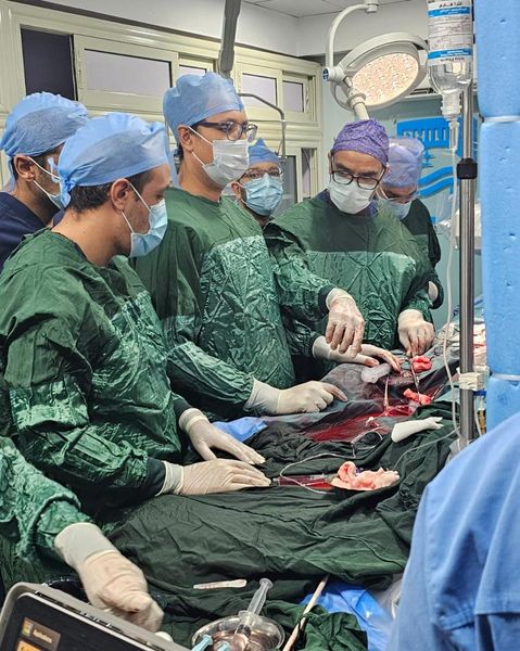 الصحة تعلن نجاح الفريق الطبي بمعهد القلب القومي بإجراء قسطرة معقدة بإستخدام جهاز الإيكمو - 1 - سيناء الإخبارية