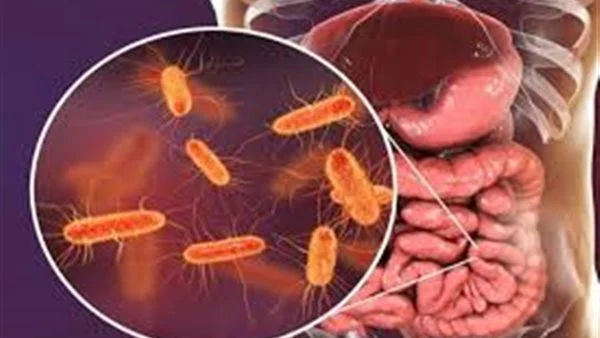 بعد إعلان الصحة عنها.. تعرف على بكتيريا " الإيكولاي " وطرق الوقاية منها - 3 - سيناء الإخبارية