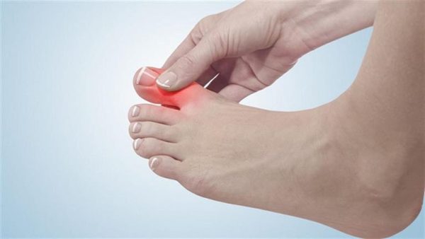 تعرف على أسباب وأعراض وطرق علاج تشنج أصابع القدم - 3 - سيناء الإخبارية
