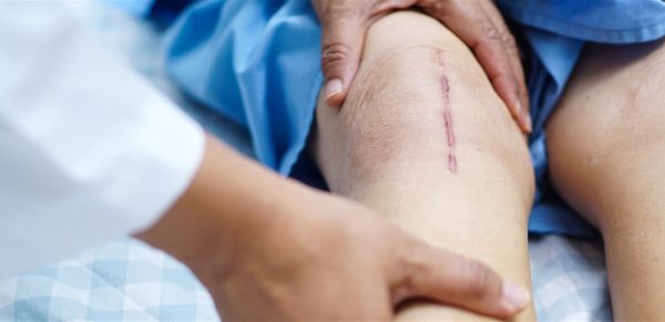 علماء روس ينجحون في استخدام الفيروسات لعلاج جروح الطلقات النارية بنسبة شفاء 80% - 1 - سيناء الإخبارية