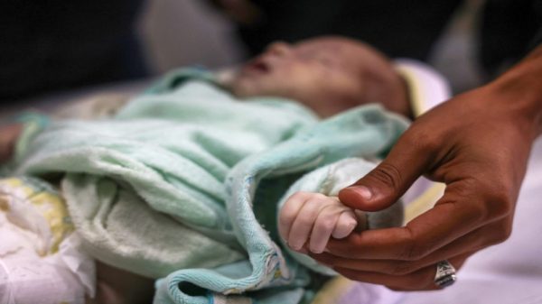 الأمم المتحدة: مليون طفل في غزة يعانون صدمات نفسية حادة وسط أزمة إنسانية خانقة - 1 - سيناء الإخبارية