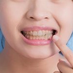 الصحة تكشف عن أبرز أسباب اصفرار الأسنان في منشور توعوي - 1 - سيناء الإخبارية