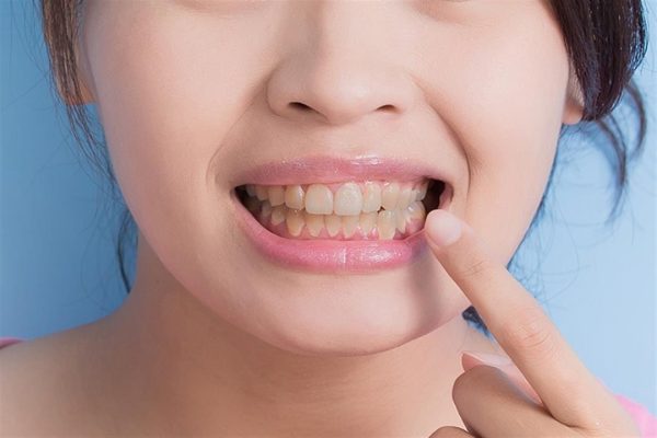 الصحة تكشف عن أبرز أسباب اصفرار الأسنان في منشور توعوي - 5 - سيناء الإخبارية