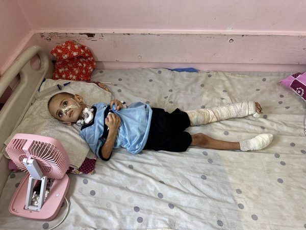 غزة تحت الحصار والجوع.. أكثر من 250 وفاة بسبب المجاعة  - 1 - سيناء الإخبارية