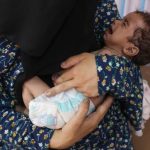 غزة.. أطفال يموتون بصمت بين خيام النزوح وجحيم المجاعة - 1 - سيناء الإخبارية