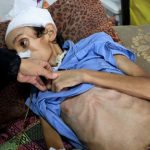 غوتيريش: غزة تحولت إلى فيلم رعب والمجاعة تفتك بالسكان - 5 - سيناء الإخبارية