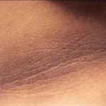 طرق طبيعية للتخلص من اسمرار الرقبة وأسبابه.. تعرف عليها - 1 - سيناء الإخبارية