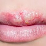 جسمك يرسل إنذارات مبكرة: 10 علامات تدل على نقص العناصر الغذائية - 1 - سيناء الإخبارية